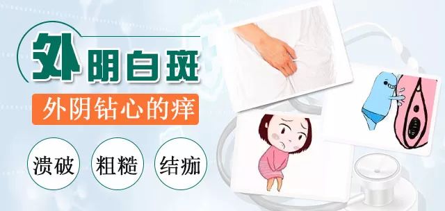 外阴白斑疾病加重都会有哪些不容忽视的表现?