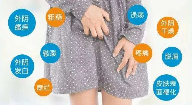 为什么年纪轻轻会有外阴白斑